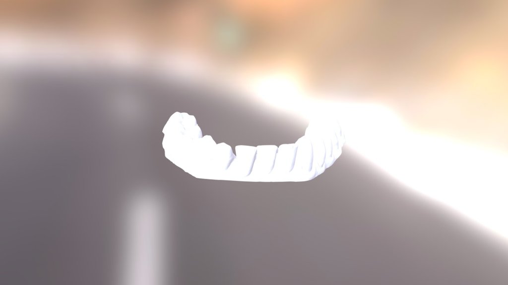 Chantel Lower Jaw