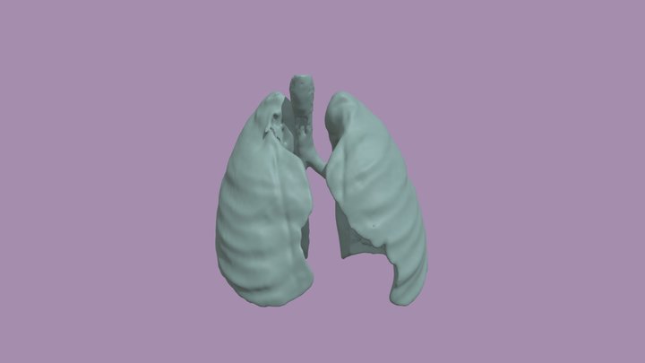 Segmentation_Lungs 3D Model