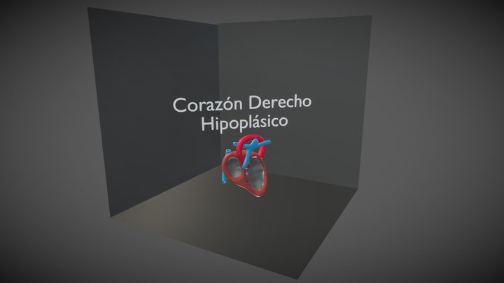 Corazón Derecho Hipoplásico 3D Model
