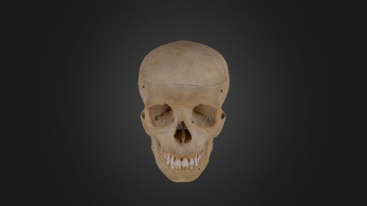 Forensic Anthro - Ancestry using Skull 3D Model