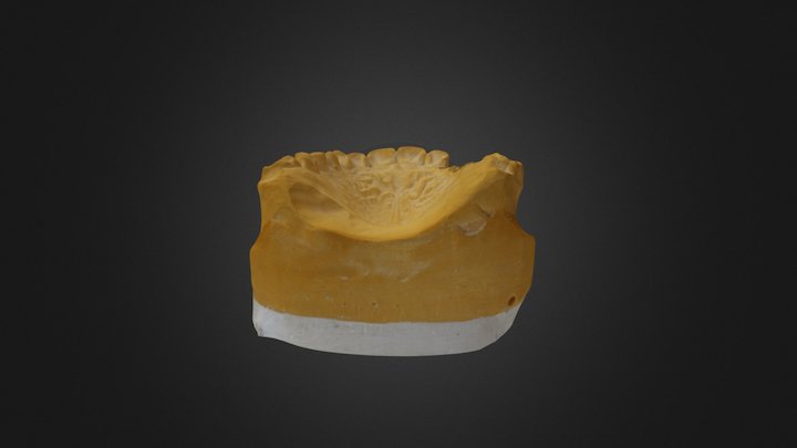 Dental prothesis 3D Model