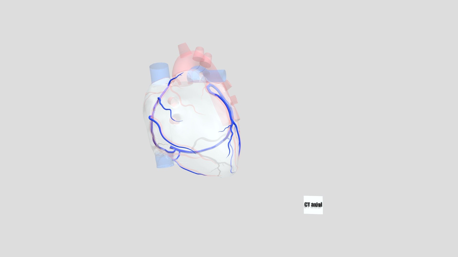 Coronary Vein System - 3D model by chayadaphechkrai [cccc392] - Sketchfab