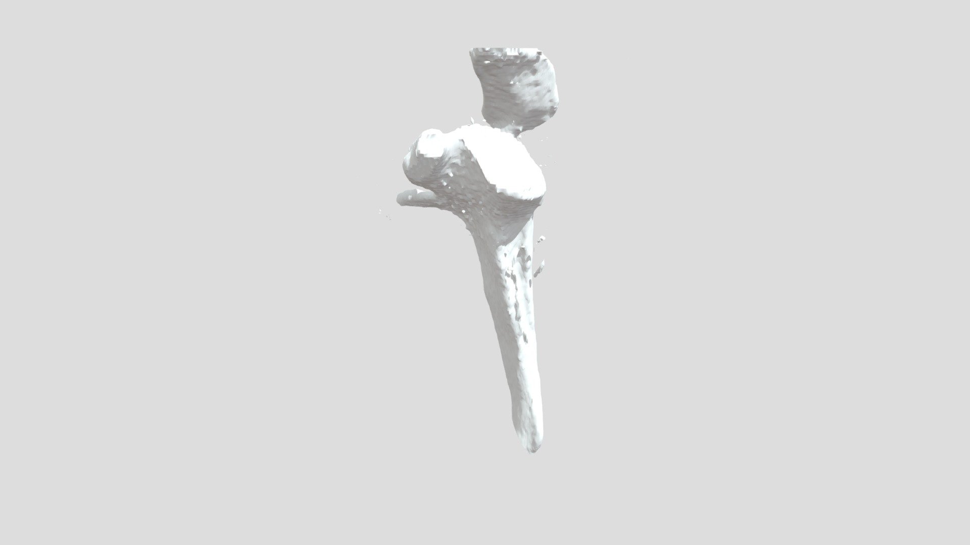 Test Recap scapula ameliorée