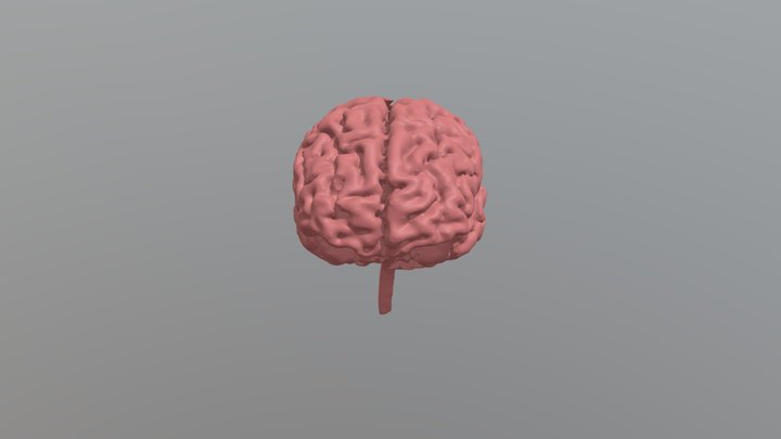 Segmentation_Brain 3D Model