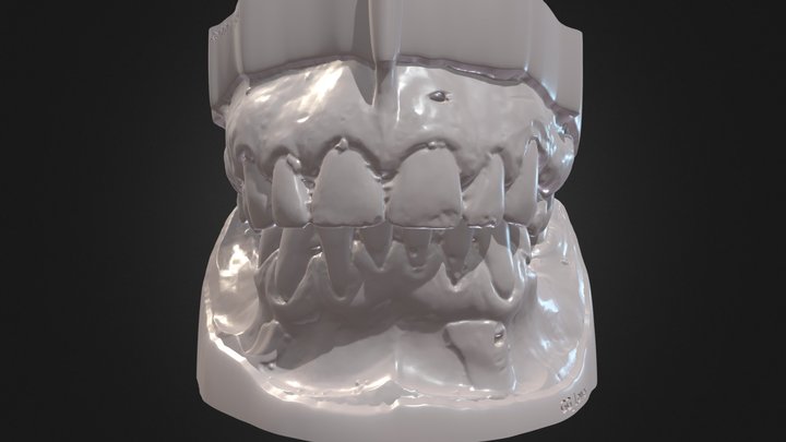 Occlusion Case GG 3D Model