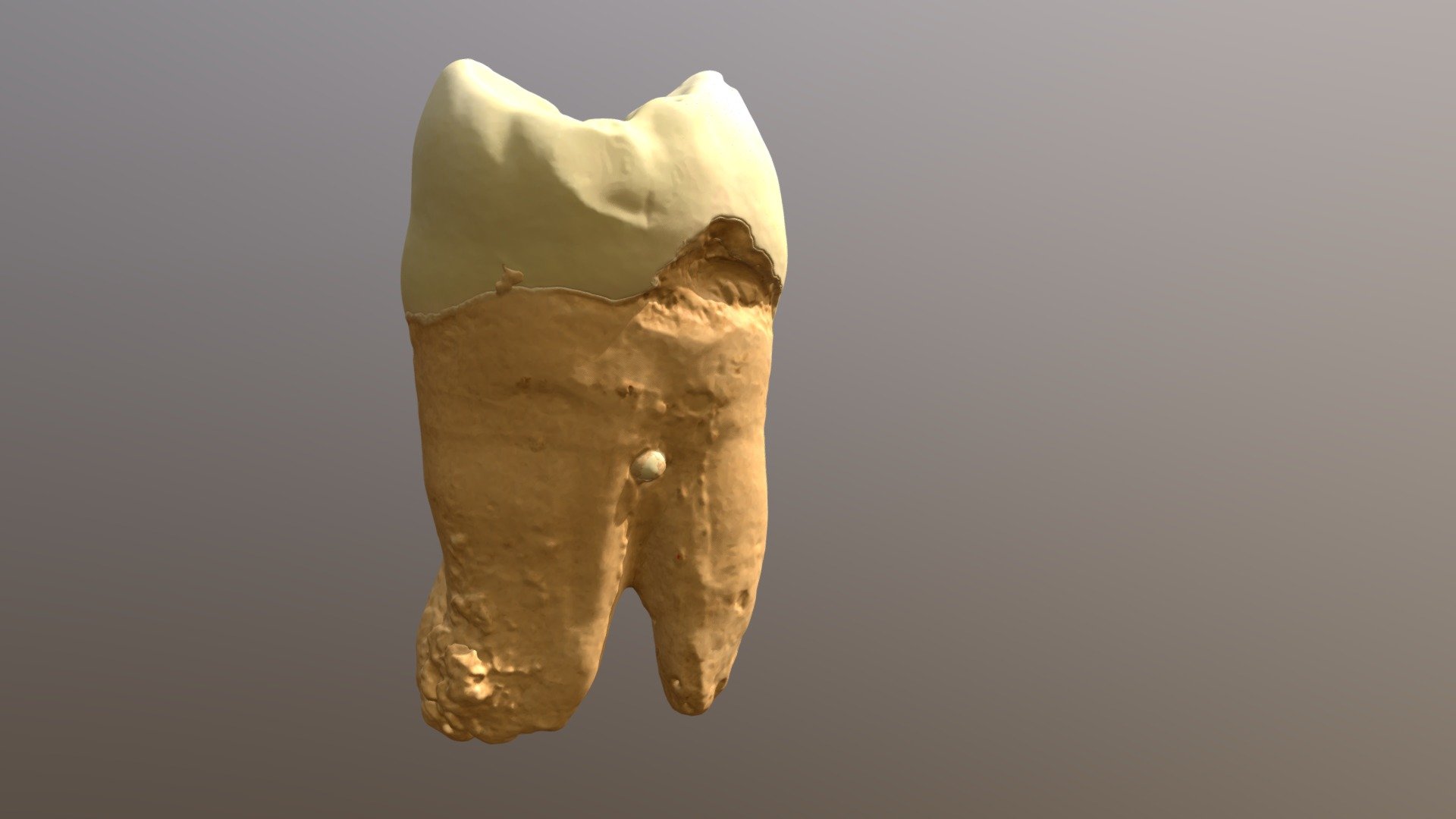 Upper Left Second Molar - 3D model by XMT [cd76613] - Sketchfab