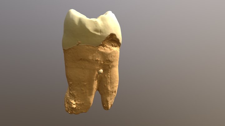 Upper Left Second Molar 3D Model