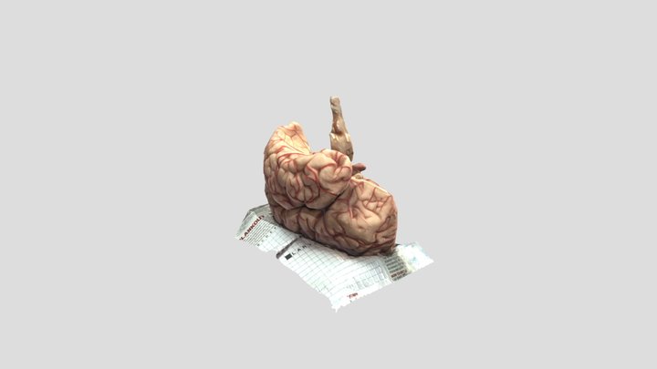 A1- Half Brain 3D Model