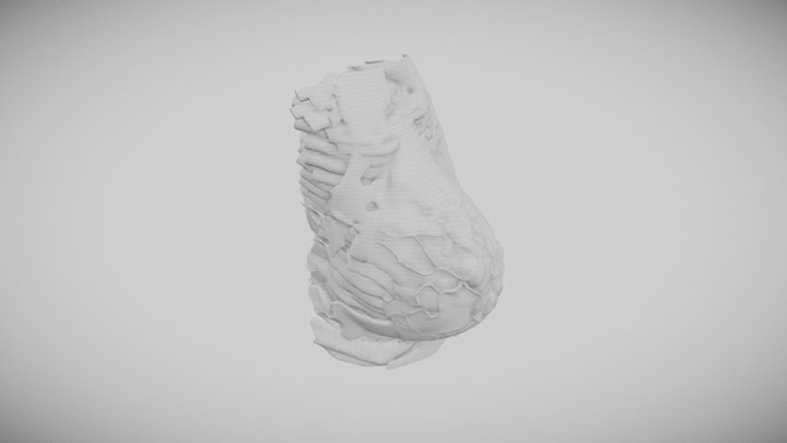 Breast 3D Model