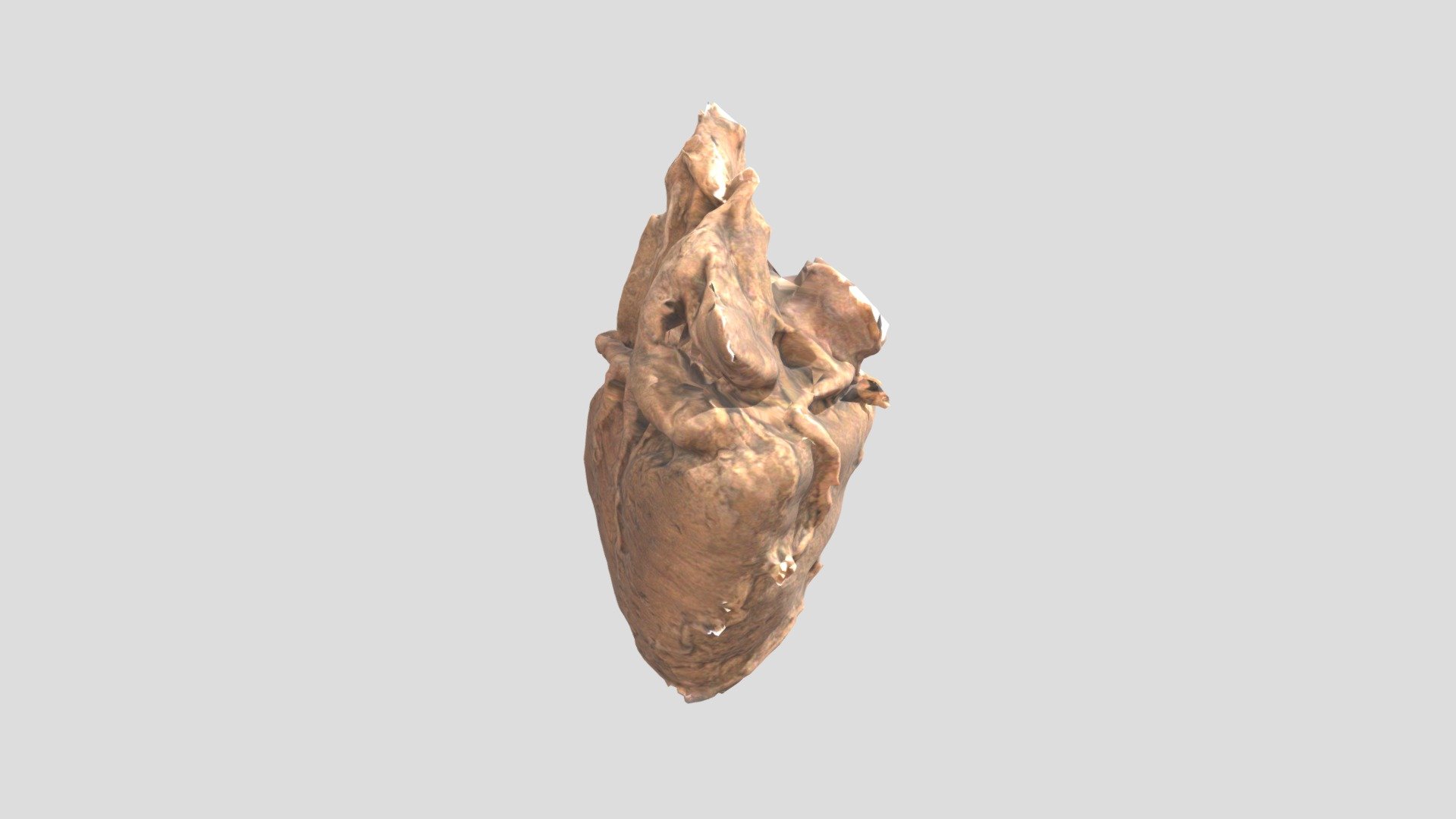 L_Coronary Dom_V3_suspended_Edit2 - 3D model by TheHeartAcademy.com ...