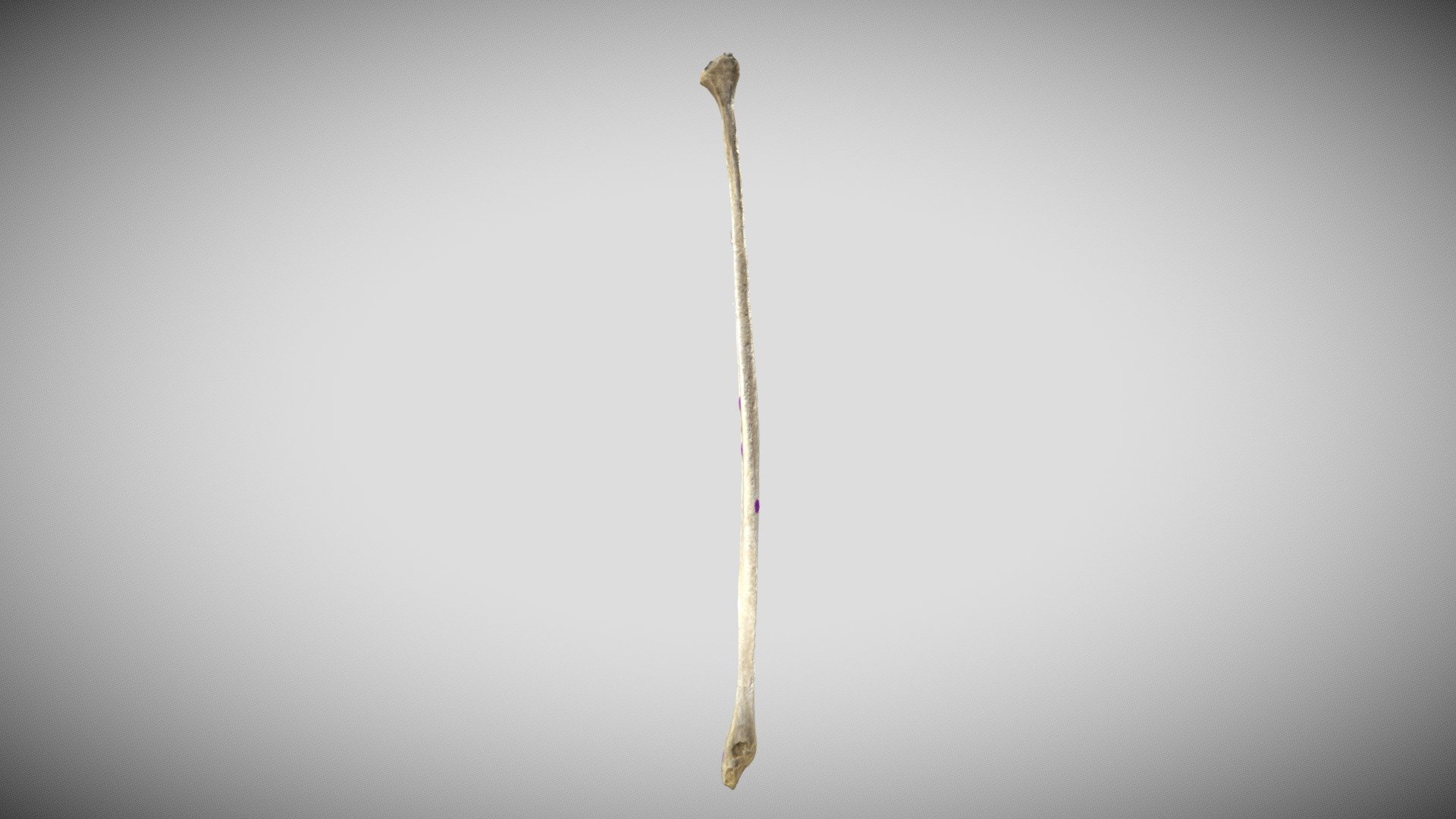 Fibula (Labeled)