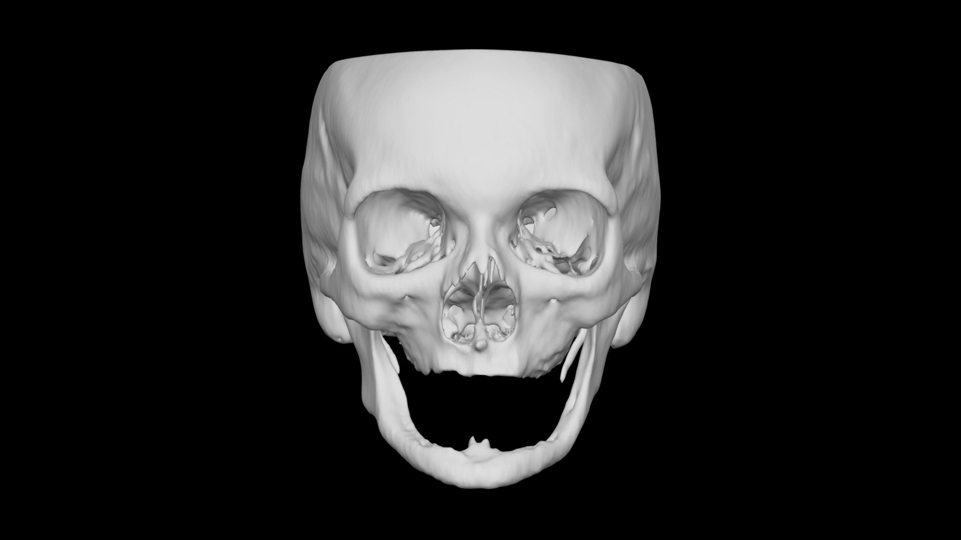 Skull Female 65yo
