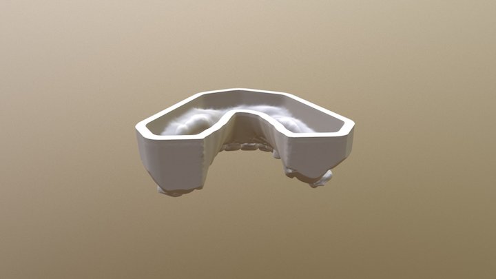 Diana Ford STL Wax Up (Chris Ibbott) 3D Model