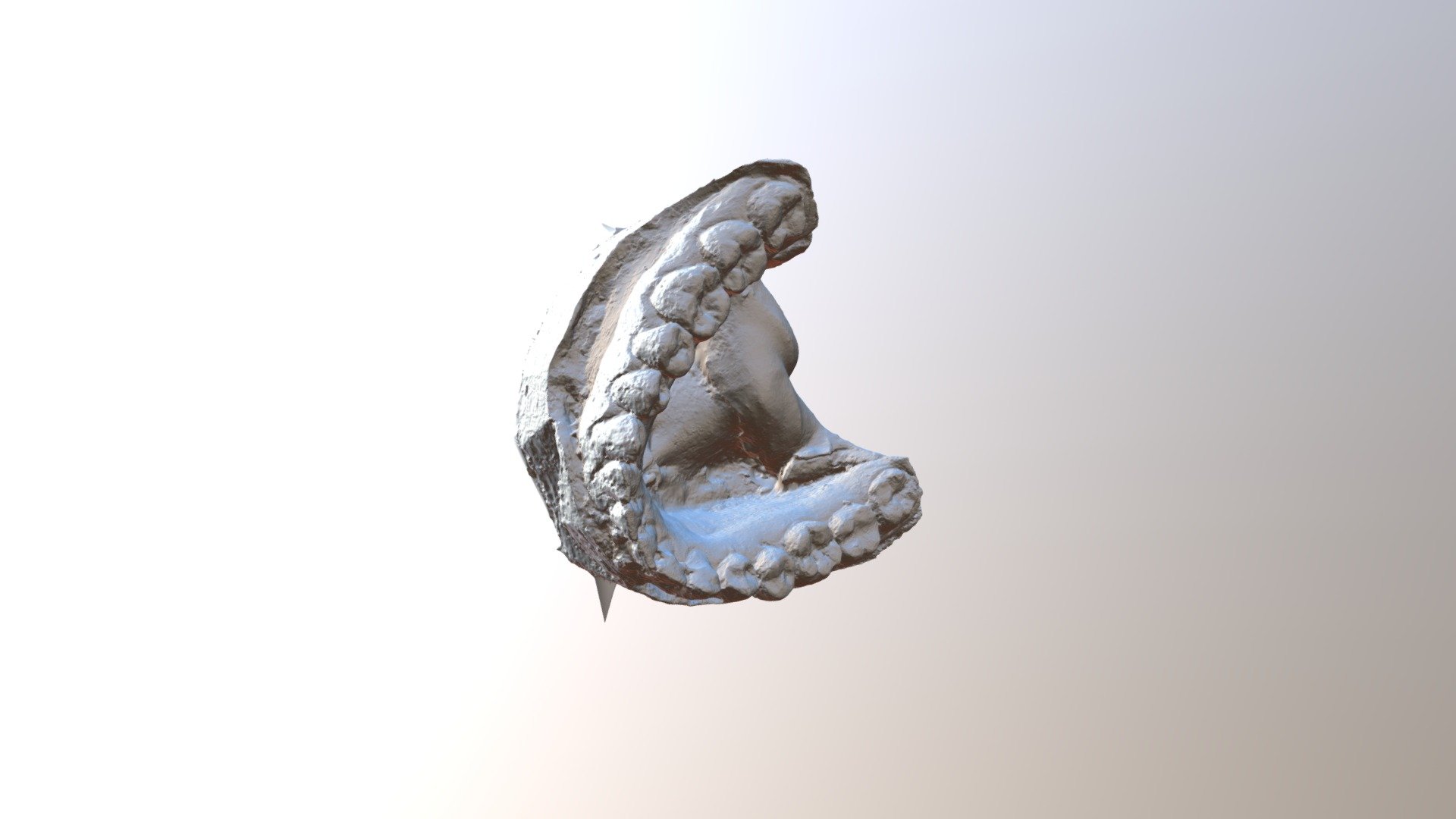mandibola