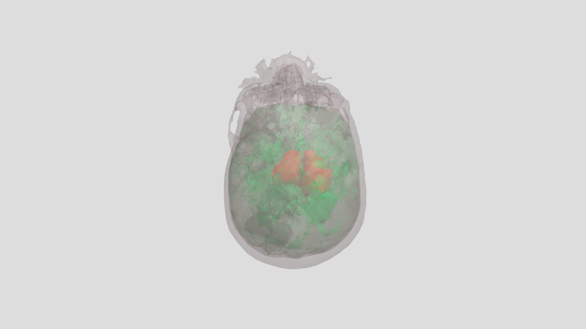Exam_3_group_Skull