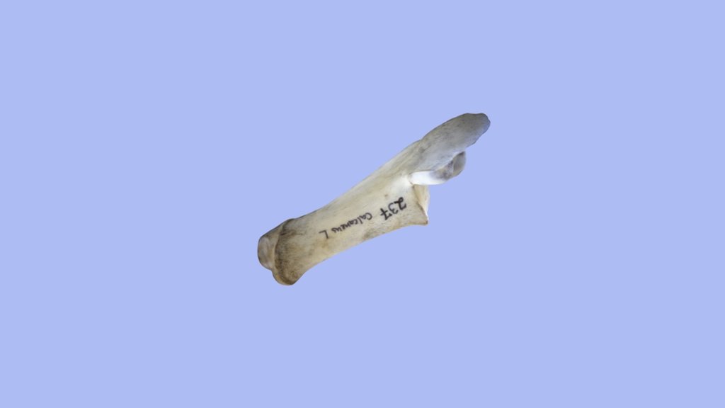 Calcaneus