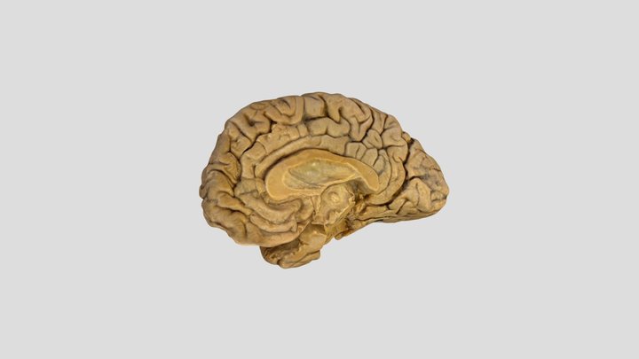 Brain stem and internal capsule 3D Model