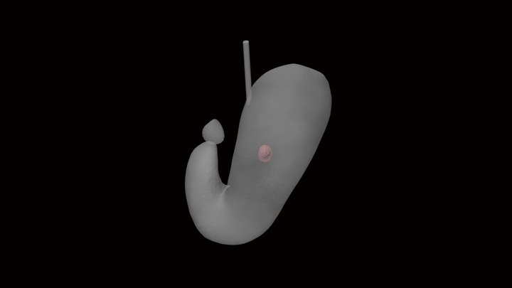 鉤状胃12 3D Model