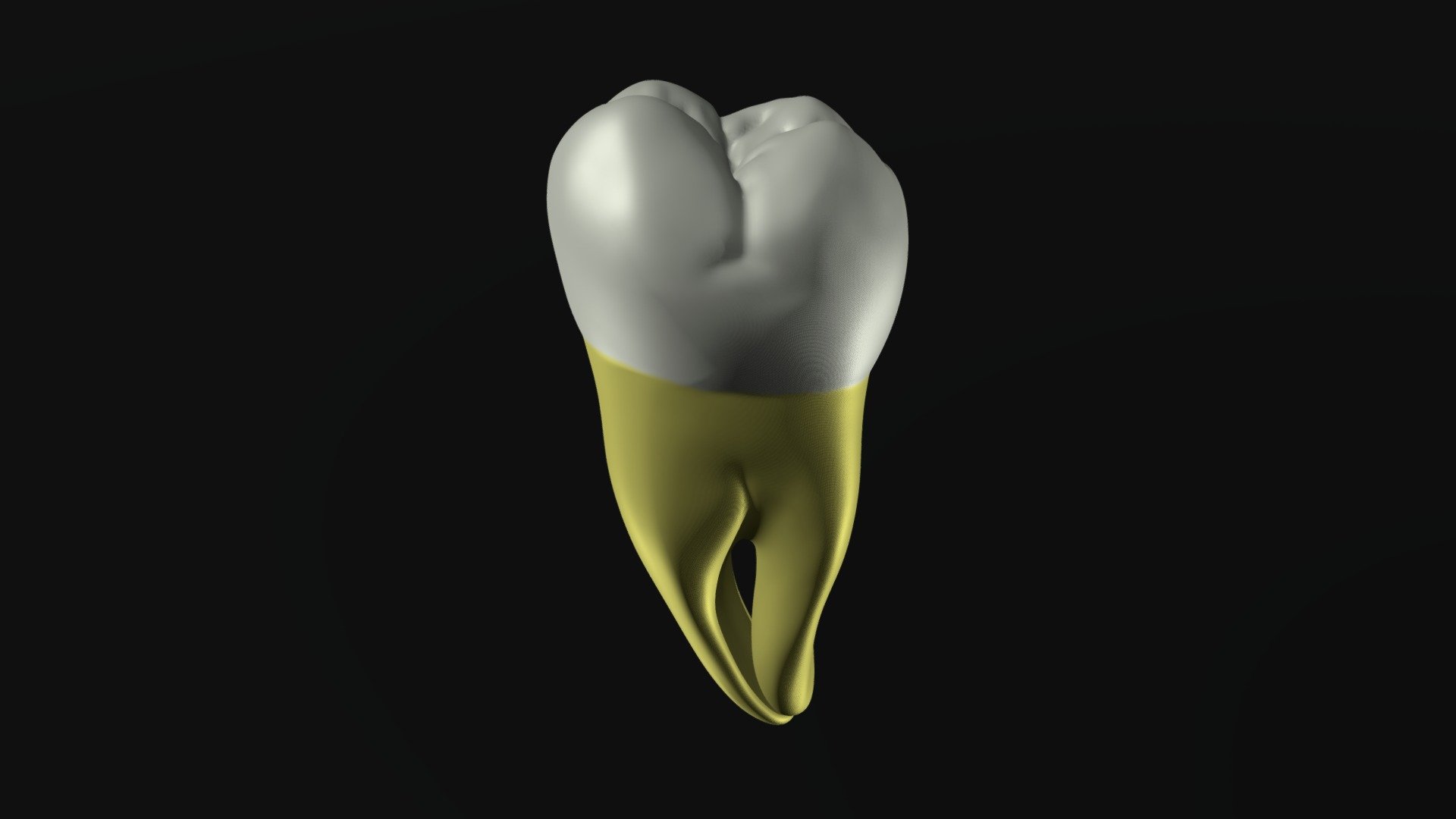 Mandibular Permanent Left Third Molar