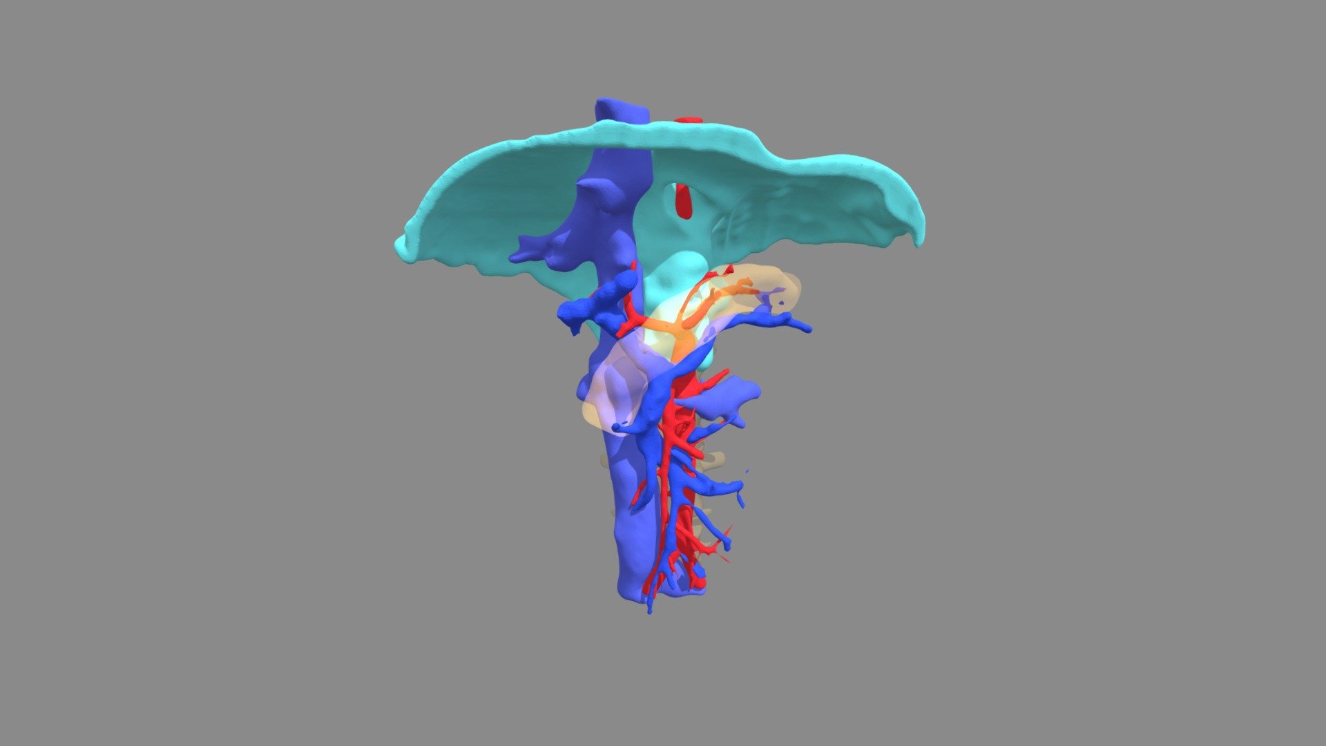 Dunbar syndrome #2 - 3D model by thorac.topsurgery [cf749b8] - Sketchfab