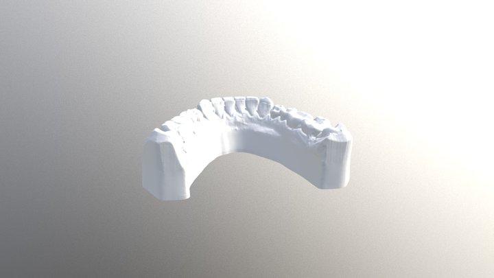 Crank - Wax Up Lower 3D Model