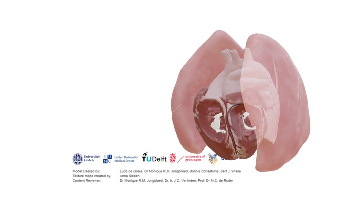 Transposition of the great arteries - open duct – Modello 3D gratuito STL