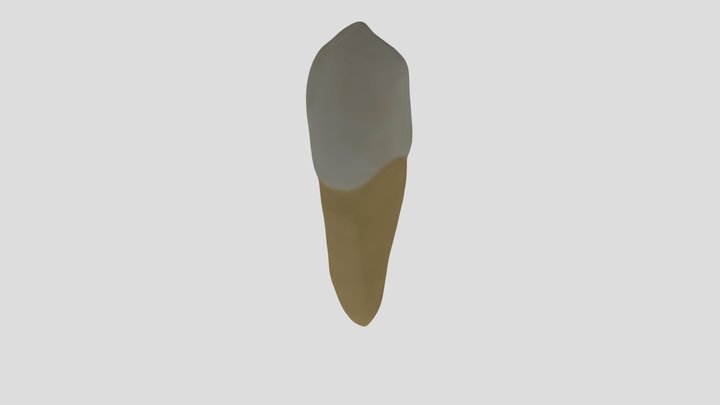 Mandibular Canine (Right)