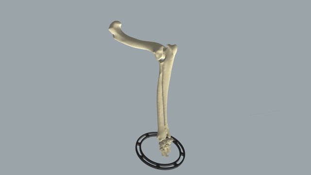 Operation on bones - animation 3D Model