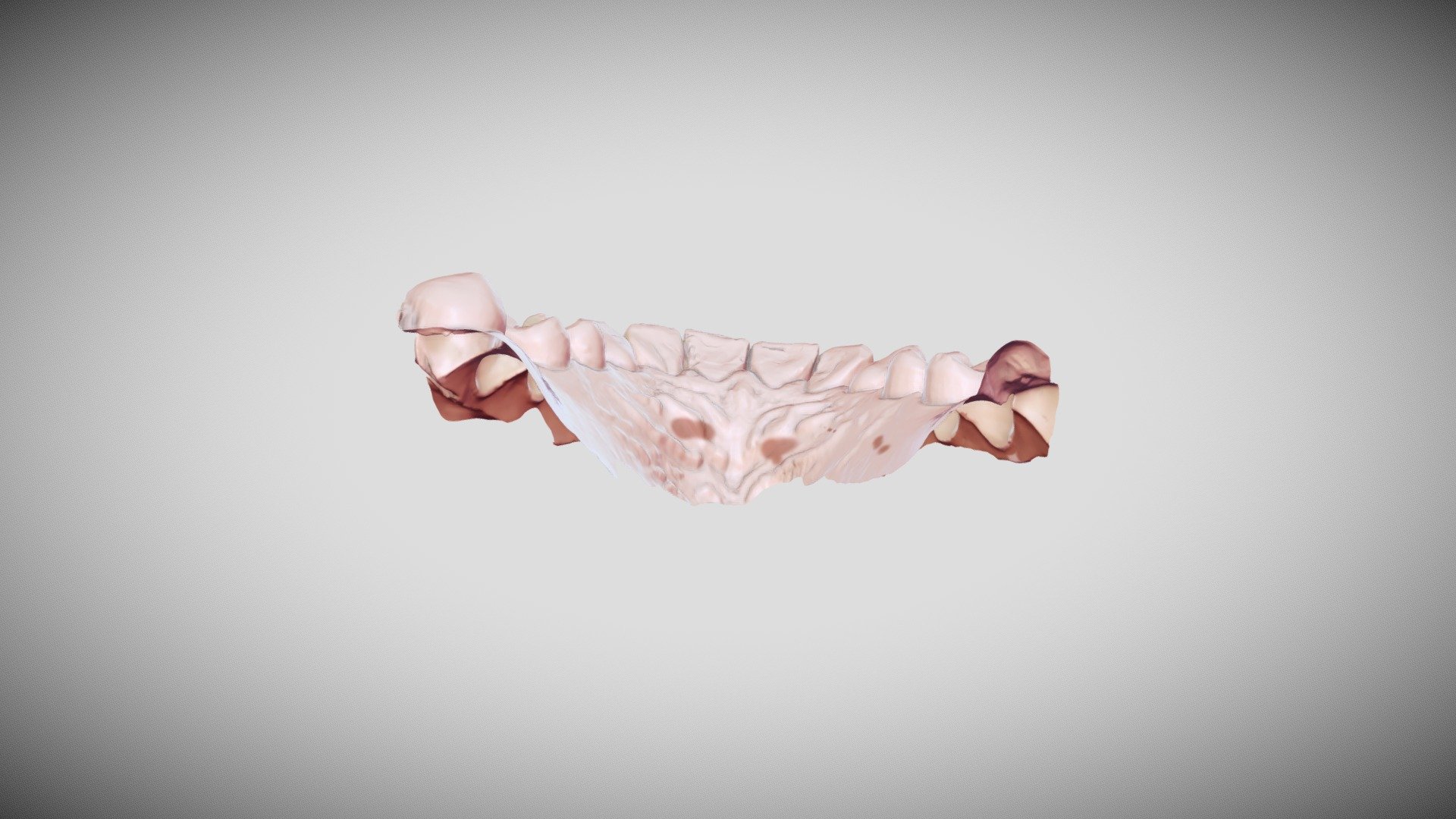 scanner intraoral+meshmixer+sketchfab