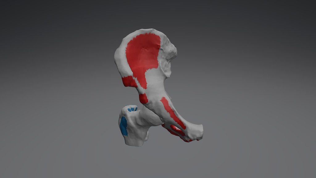 Coxal Derecho + Fémur Proximal - 3D model by Clínica 3D (@clinica3d ...