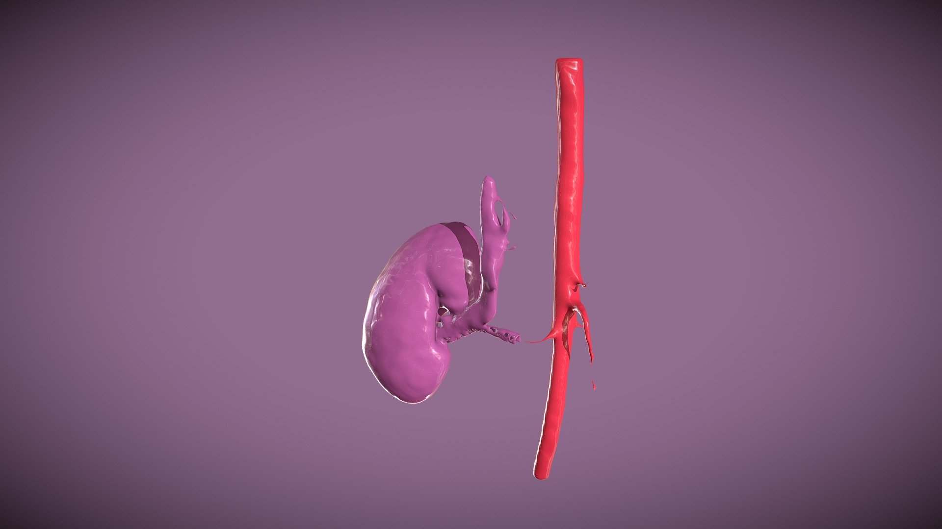 CTACardio Segmentation