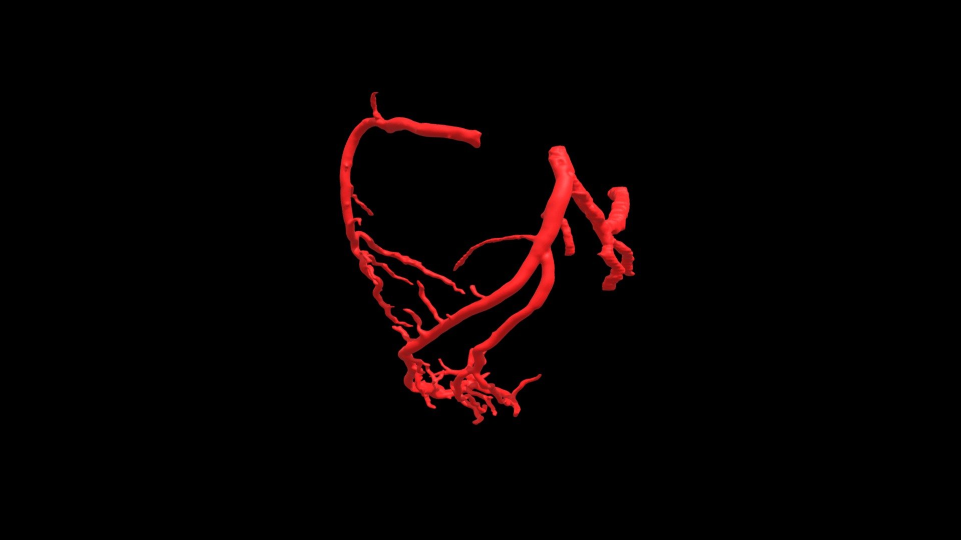 Heart0103 Coronary Arteries - Download Free 3D model by ...