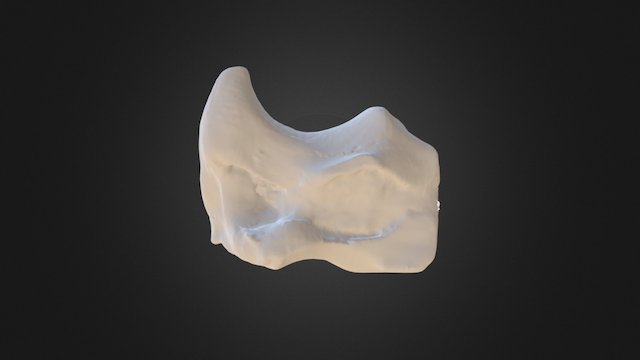1310002 Radial Carpal Right 3D Model