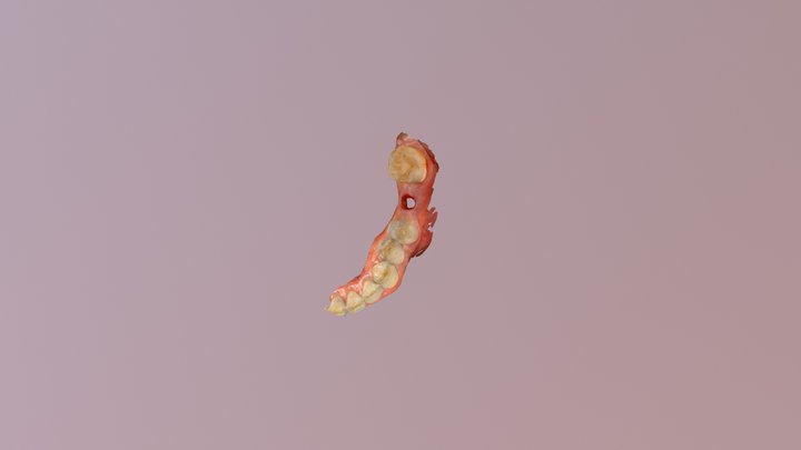 Dental implant case 3D Model