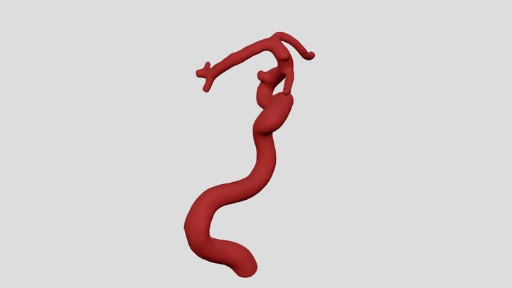 Aneurysm_059/21 3D Model