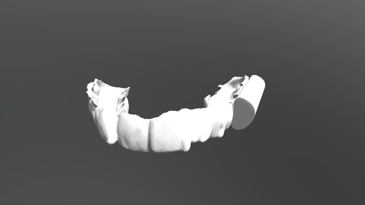 TGM attached to retainer or occlusal splint 3D Model