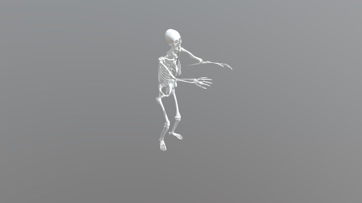 CT scan results bone 3D Model