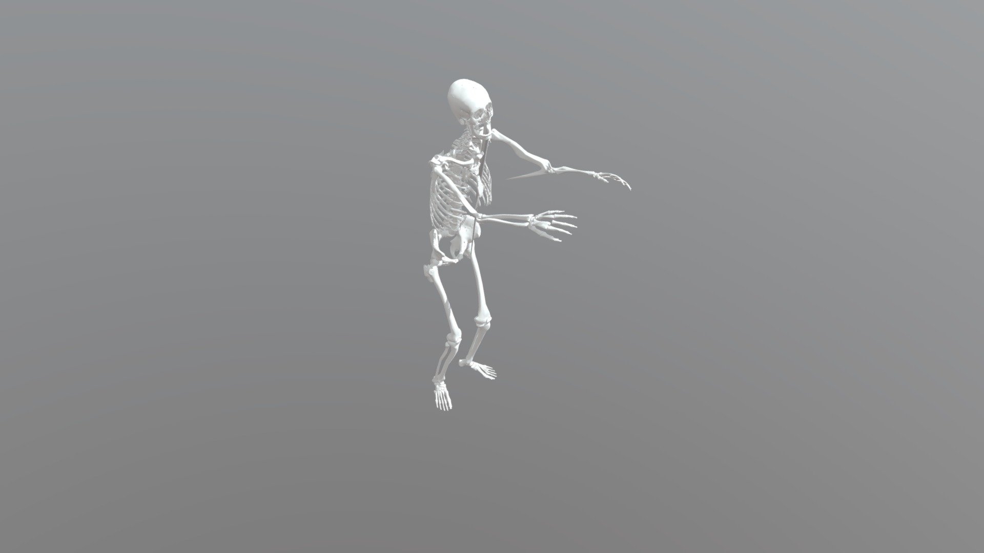 CT scan results bone