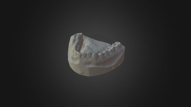 Dental impression casting 3D Model