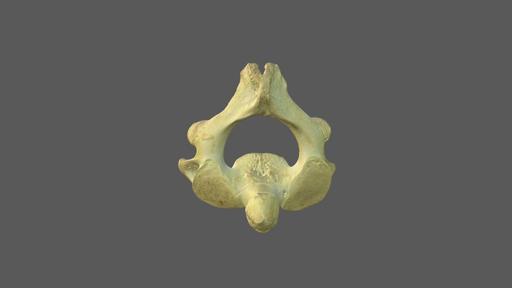 Cervical Vertebra 2 with Texture