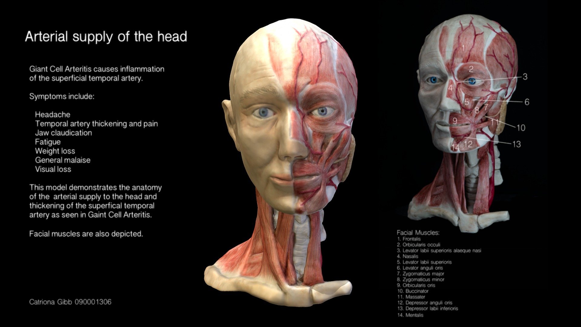 Arterial supply to head
