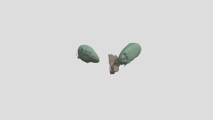 Segmentation of Aorta and Kidney 3D Model
