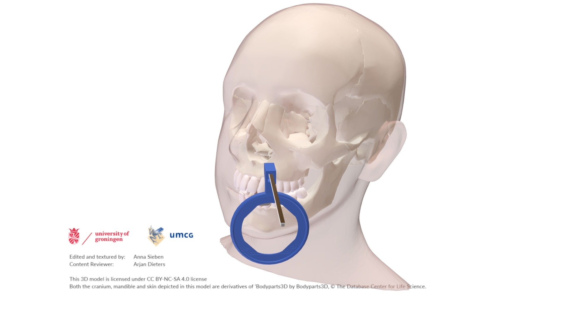 Dental Intra Oral X-ray Positioner, Periapical