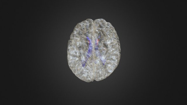 Brain w accumbens 3D Model
