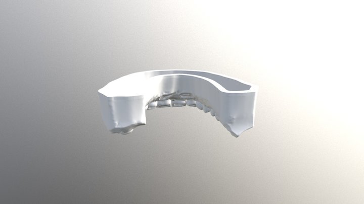 Crank - Wax Up Upper 3D Model