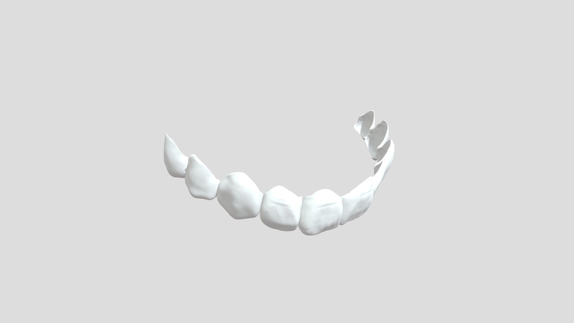Easy Smile Veneers