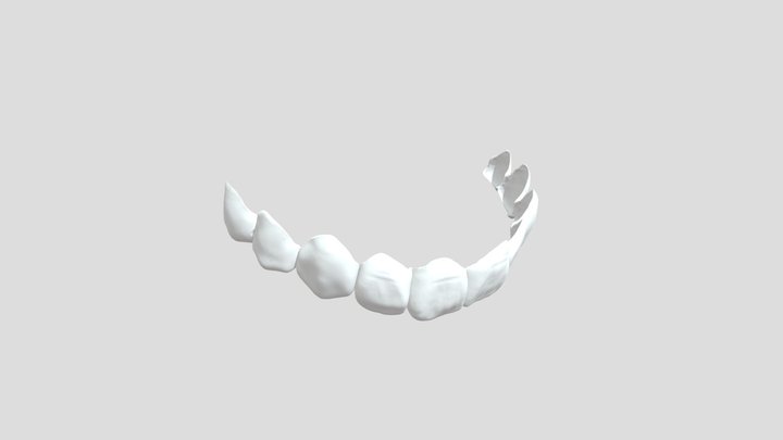 Easy Smile Veneers