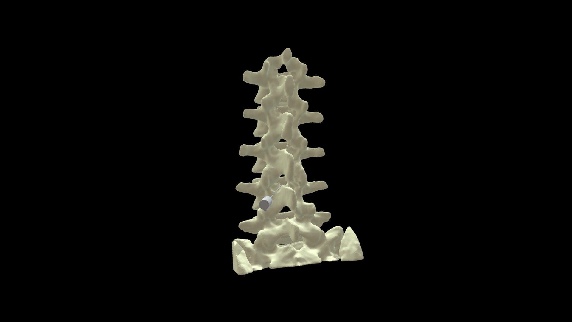 Lumbar Puncture — Sketchfab embed 3D viewer