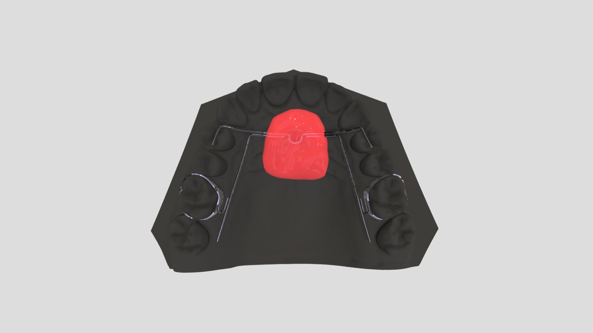 INMAN DISTALIZER - 3D model by neortholab [d34cc54] - Sketchfab