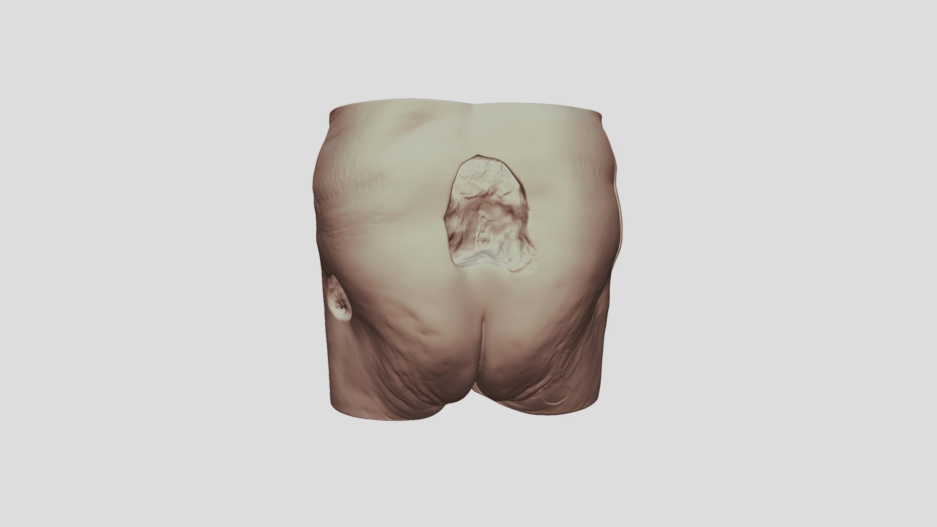 Seymour II Wound Care Model-0910 — Sketchfab embed 3D viewer